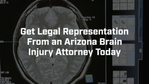 Get legal representation from an Arizona brain injury lawyer today