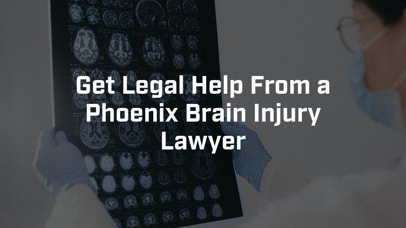 get legal help from a phoenix brain injury lawyer