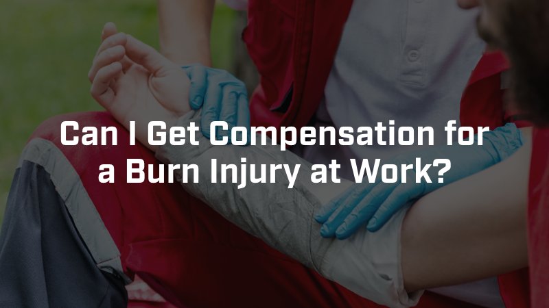 Can I Get Compensation for a Burn Injury at Work?