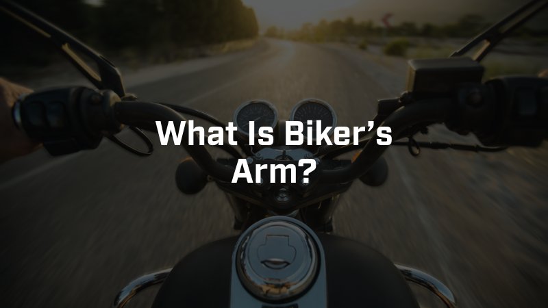 What Is Biker’s Arm?